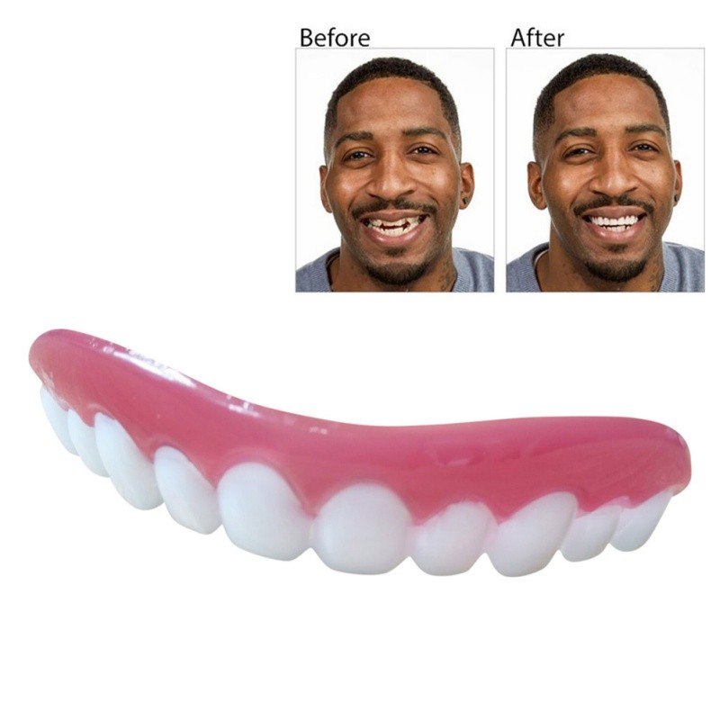 New Perfect Smile Veneers In Stock False Teeth Bad Teeth Veneers Teeth Teeth Whitening Powder Temporary Replace Cautery