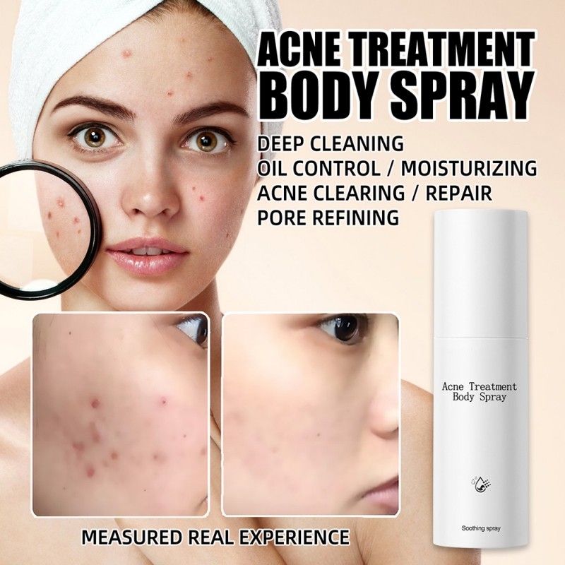 Acne Body Spray 100ml Body Chest Butt Back Acne External Use Multiple Daily Uses For All Skin Types Acne Treatment