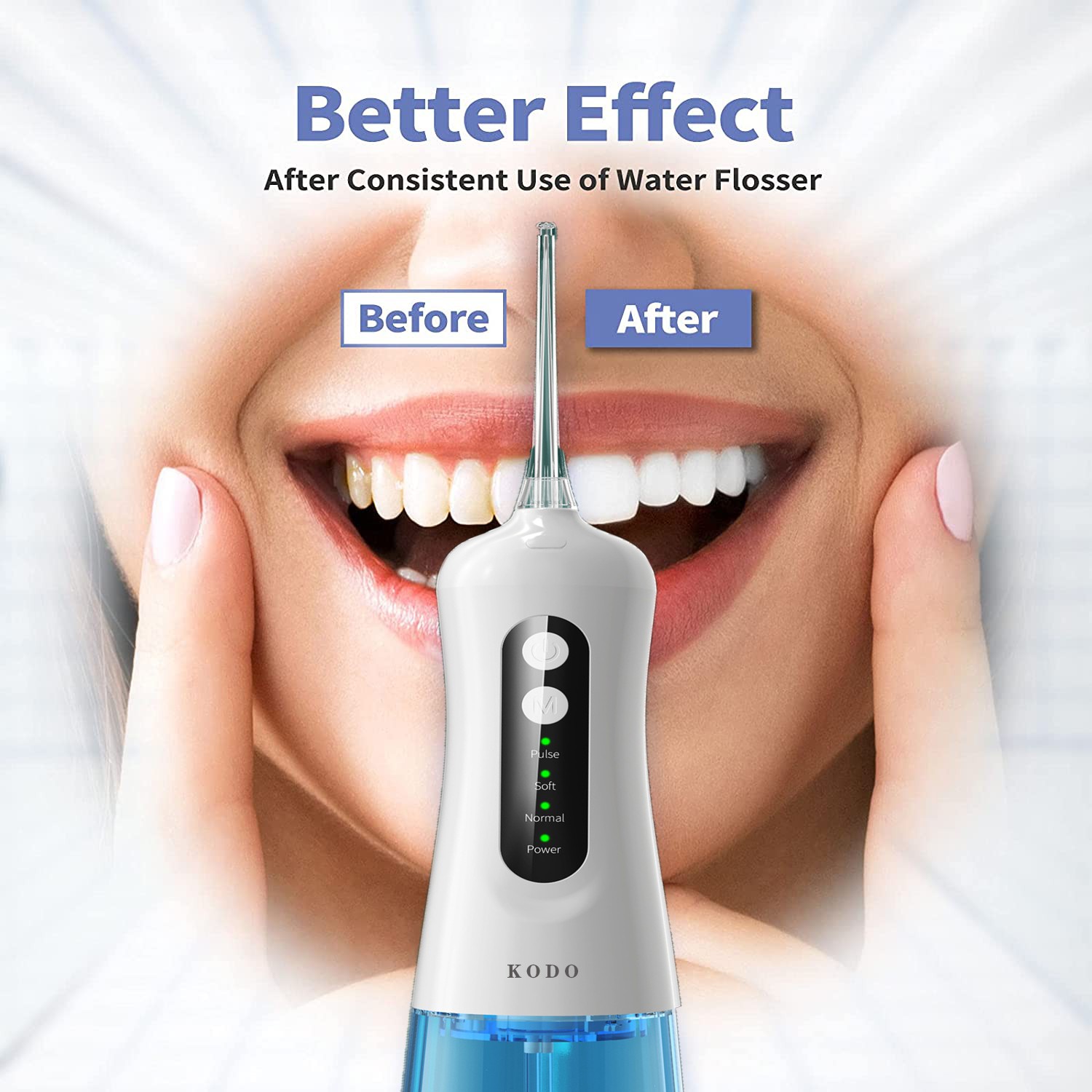 KUDO Oral Irrigator Dental Water Flosser USB Rechargeable Portable Dental Water Jet 300ml Dental Irrigator Floss