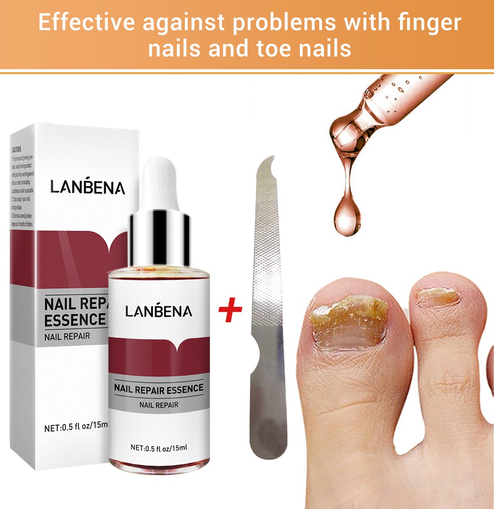 Nail Fungal Treatment Essence Foot Toe Nail Fungus Removal Gel Anti Infection Paronychia Nails Nail Repair