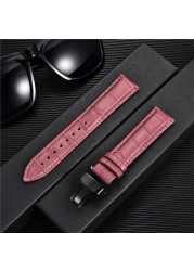 REMZEIM New Watch Band Strap Woman Watchbands Genuine Leather Strap Watch Band 18mm 20mm 22mm 24mm Multicolor Watch Bands