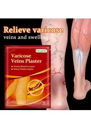 6pcs Varicose Veins Treatment Chinese Herbal Medicine Removal Phlebitis Vasculitis Spider Leg Veins Pain Plaster