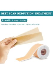 Cute Invisible Scar Sticker Skin Color Surgery Burn Skin Tape Acne Cover Sticker Silicone Gel Cover Scar