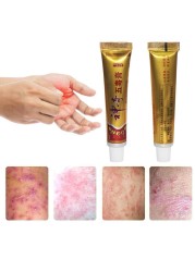 YIGANERJING Useful Psoriasis Cream (without retail box)