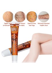 Sumifun New Varicose Veins Treatment Cream 100% Original Fibroid Vasculitis Spider Pain Relief Ointment Medical Plaster