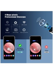 NP20 Smart Ear Cleaner Stick with Endoscope 400W High Precision Wireless Earwax Remover Set Rechargeable Otoscope Cleaning Tools