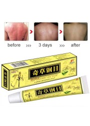 10pcs YIGANERJING QICAOGANGMU Dermatitis Eczematoid Psoriasis Treatment Cream Zudaifu