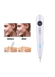 LCD Mole Freckle Removal Pen Wart Removal Spot Plasma Pen Tattoo Black Point Remover Face Body Clean Beauty Skin Care Tool