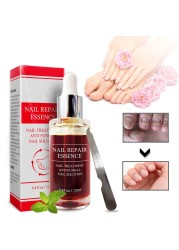 LANBENA - Fungus repair serum, nail care treatment, anti-infective gel, paronychia, onychomycosis