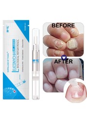 3ml Nail Repair Liquid Pen With Brush Cute Anti Fungus Remover Onychomycosis Paronychia Foot Nail Fungus For Nails Manicure