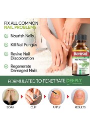 Fungal Nail Treatment Essential Oil Whitening Hand And Foot Toe Nail Fungus Remove Infection Feet Care Polish Nail Gel 50ml