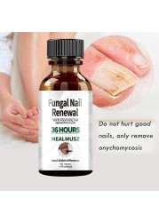 Fungal Nail Treatment Serum Onychomycosis Paronychia Anti-Fungal Nail Infection Herbal Toe Fungus Foot Repair Essence Care 50ml