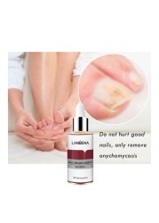 12ml Nail Fungal Repair Serum Nail Anti-infection Paronychia Onychomycosis Nail Toe Nourishing Brighten Foot Nail Care TSLM1