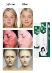 10pcs/20pcs Whitening Freckle Removal Cream Melasma Cream Remove Dark Spots Melanin Melanin Remover Skin Care Bleaching Cream