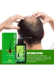 Hair Loss Treatment Growth Hair for Men Women1pcs120ml Neo Hair Lotion Hair Growth Serum Essence Oil