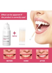 GlorySmile Teeth Whitening Essence Oral Hygiene Clean Remove Plaque Stains Fresh Breath Teeth Whitening Tools