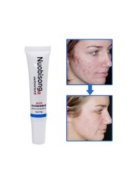 Nuobisong Face Skin Care Treatment Facial Pimples Scar Stretch Marks Removal Acne Treatment Whitening Moisturizing Cream