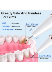 جهاز تنظيف الأسنان الكهربائي بالموجات فوق الصوتية لإزالة بقع الأسنان عن طريق الفم لوحة ترتر قشارة الحيوانات الأليفة أدوات تبييض الأسنان الحجرية