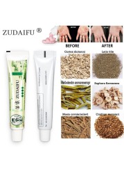 5pcs Original Zudaifu Body Psoriasis Cream Wholesale Yiganerjing 15g Without Box