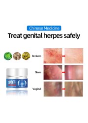 Male Genital Herpes Medicine Cream Genital Treatment Men Balanitis Antibacterial Anti-burn Odor Removal Treatment Herpes Zoster