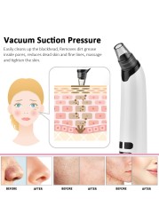 Facial Cleanser Blackhead Remover Deep Pore Acne Pimple Removal Vacuum Suction Diamond T Zone Beauty Facial Tool Household Spa