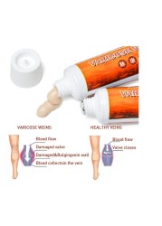 Sumifun New Varicose Veins Treatment Cream 100% Original Fibroid Vasculitis Spider Pain Relief Ointment Medical Plaster