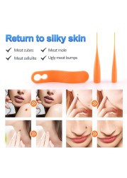 Dermal Removal Kit 2 in 1 Skin Tag Removal Micro Band 4-6mm For Papillomas Berrugas Warts Mole Removal Wart Face Care