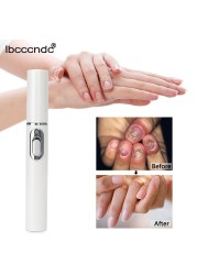 Nail Fungus Pen Anti Fungus Home Set Toe Nail Onychomycosis Paronychia Anti Fungus Care Repair Serum