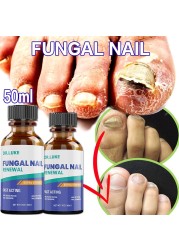 50ml Nail Repair Extract Anti Fungal Nail Treatment Remove Mycosis Nourishing Brighten Hand Foot Toes Nail Care