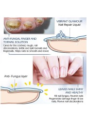 Nail Repair Serum Nail Fungal Treatment Serum Onychomycosis Paronychia Anti-Fungal Nail Infection Toe Fungus Foot Repair Care