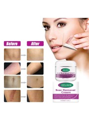 Moon Bevy Skin Removal Cream 50ml Acne Scar Remover For Women Anti Aging Cream For Body Care