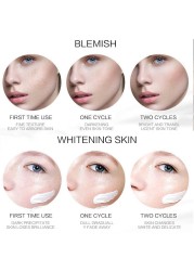 Effective Whitening Freckle Cream Gel Remove Melasma Acne Spot Pigment Melanin Dark Spots Pigmentation Moisturizing Skin Care