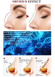 2pcs Nose Up Increase Rhinoplasty Essential Oil Charming Women Nose Repair Massage Essential Oil Nose Lifting Beauty Care