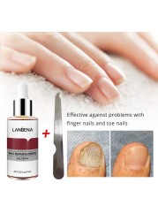 Nail Fungal Treatment Essence Foot Toe Nail Fungus Removal Gel Anti Infection Paronychia Nails Nail Repair