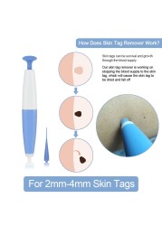 Warts & Warts Removal Kit Skin Tag Killing Skin Moles Fine Skin Tag With Cleansing Adult Warts Face Care