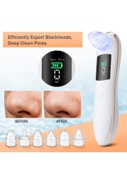 Electric Red and Blue Light Blackhead Remover Blackhead Pore Cleaner Acne Removal Deep Cleaning Skin Care