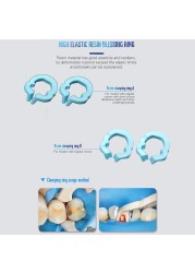 Dental Resin Clamping Ring Spacer Sectional Ring Contoured Metal Matrices Holder Matrix Fixed Clamp Autoclavable