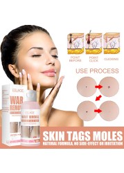 Skin Tag Wart Removal Against Mole Quick Removal Kit Papillary Treatment Natural Herbal Anti Verruca Non Irritant Non Toxic