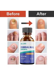 50ml Nail Repair Extract Anti Fungal Nail Treatment Remove Mycosis Nourishing Brighten Hand Foot Toes Nail Care