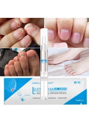 3ml Nail Repair Liquid Pen With Brush Cute Anti Fungus Remover Onychomycosis Paronychia Foot Nail Fungus For Nails Manicure