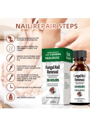 Fungal Nail Treatment Serum Onychomycosis Paronychia Anti-Fungal Nail Infection Herbal Toe Fungus Foot Repair Essence Care 50ml