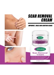 Moon Bevy Skin Removal Cream 50ml Acne Scar Remover For Women Anti Aging Cream For Body Care