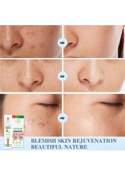 Effective Whitening Freckle Cream Gel Remove Melasma Acne Spot Pigment Melanin Dark Spots Pigmentation Moisturizing Skin Care