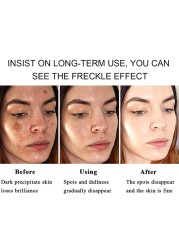 10pcs/20pcs Whitening Freckle Removal Cream Melasma Cream Remove Dark Spots Melanin Melanin Remover Skin Care Bleaching Cream