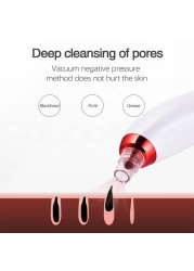 Microcrystal Blackhead Remover Vacuum Suction Facial Pimple Acne Blackhead Remover Facial Pore Cleaner & Sprayer Skin Care Tool