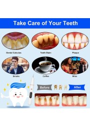 جهاز تنظيف الأسنان الكهربائي بالموجات فوق الصوتية لإزالة بقع الأسنان عن طريق الفم لوحة ترتر قشارة الحيوانات الأليفة أدوات تبييض الأسنان الحجرية