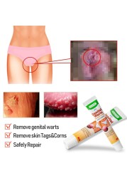 2pcs Wart Remover Ointment Genital Herpes Congenital Vulva Acuminatum Skin Tag Remover Antibacterial Treatment Cream A658