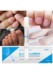 Fungal Nail Pen, 3ml, Effective, Onychomycosis, Paronychia, Anti-infection, Fungi, Repair Solution, Toenail Treatment Gel, Nourishing Essence