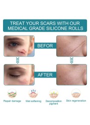 Cute Invisible Scar Sticker Skin Color Surgery Burn Skin Tape Acne Cover Sticker Silicone Gel Cover Scar