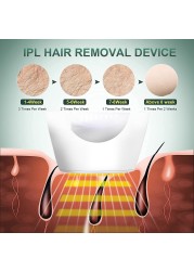 2022New 900000flash es آلة لنزع الشعر بالليزر الليزر الساخن بيع دائم IPL آلة إزالة الشعر بالليزر آلة إزالة الشعر الكهربائية غير مؤلم